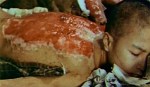 nagasaki-burned-boy